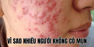 Ảnh Thumb bài viết[1]