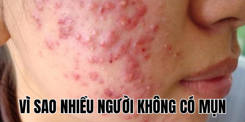 Ảnh Thumb bài viết[1]