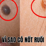 Ảnh Thumb bài viết[1]