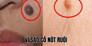 Ảnh Thumb bài viết[1]
