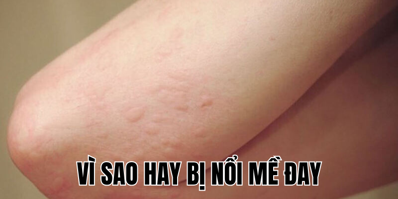 Ảnh Thumb bài viết[1]