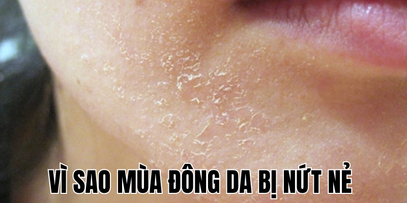 Ảnh Thumb bài viết[1]