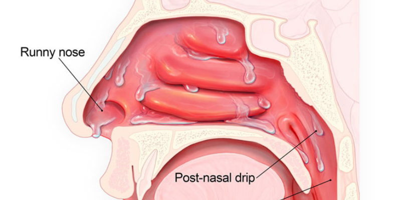 Ảnh trong bài 1[1]