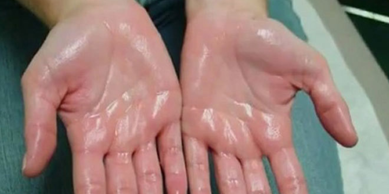 Ảnh trong bài 1[1]