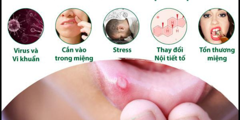 Ảnh trong bài 1[1]