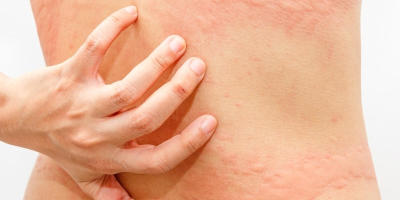 Ảnh trong bài 1[1]