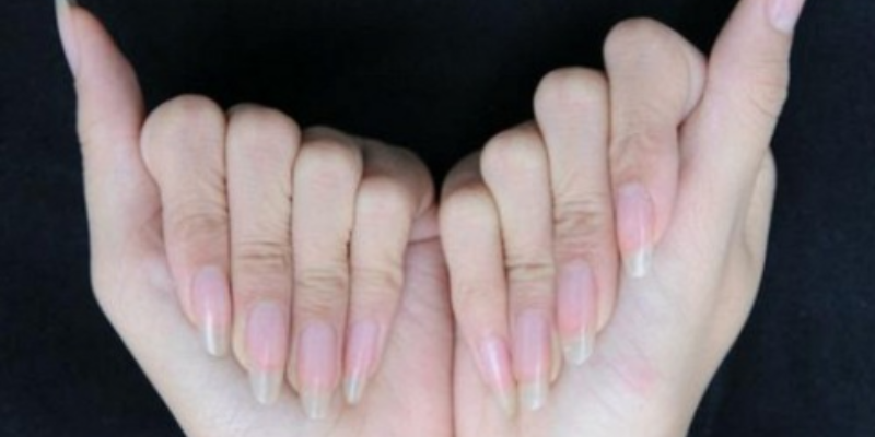 Ảnh trong bài 1[1]