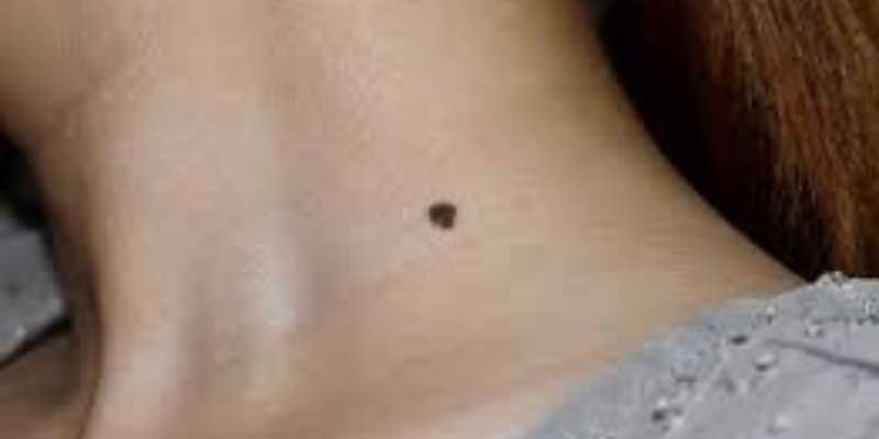 Ảnh trong bài 2[1]