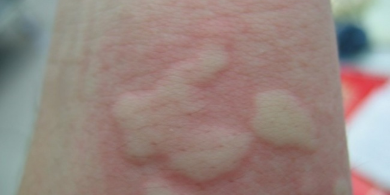 Ảnh trong bài 2[1]