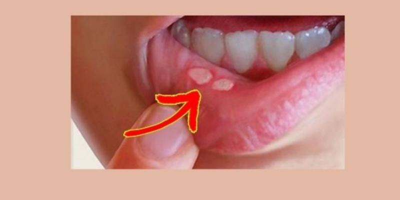 Ảnh trong bài 2[2]