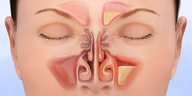 Ảnh trong bài 3[1]