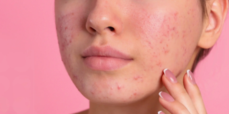 Ảnh trong bài 3[1]