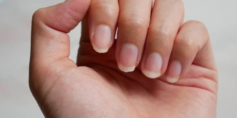 Ảnh trong bài 3[1]