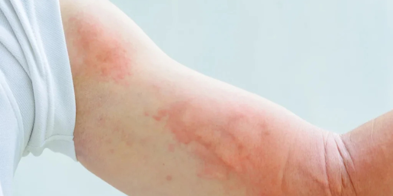 Ảnh trong bài 3[2]